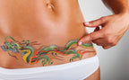 tummy tuck temporary tattoo scar cover-up DIEP flap breast reconstruction abdominoplasty c-section