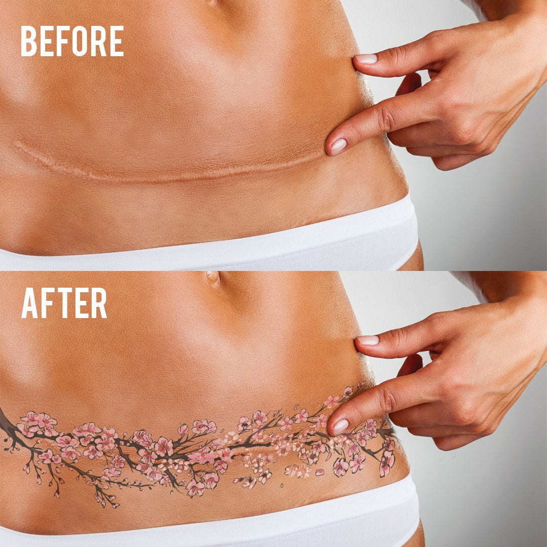 Sayura Cherry Blossom Abdominal/Mastectomy Tattoo